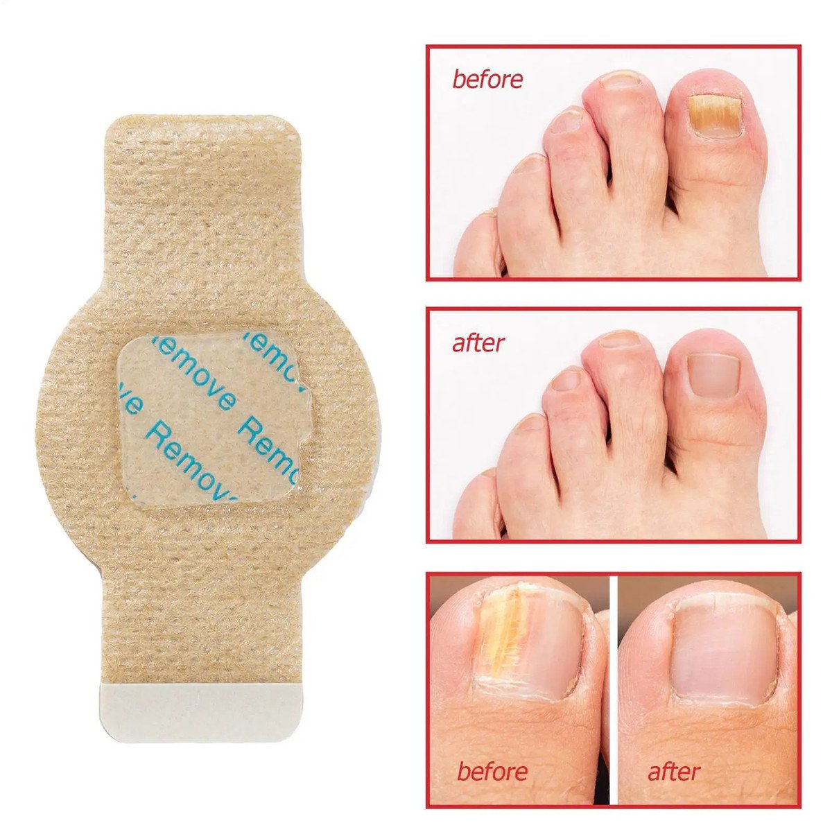 Fungal Nail Patches (21 PCS)
