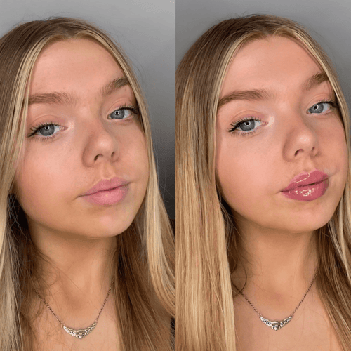 Volumising Lip Plumpler