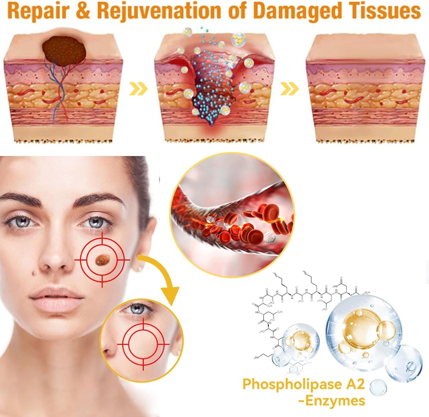 60g Bee Venom Wart Remover