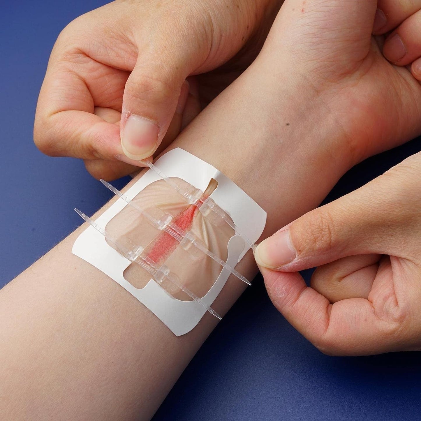 8Pcs Zipper Tie Wound Closure Patch