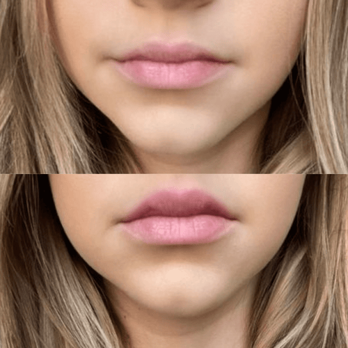 Volumising Lip Plumpler