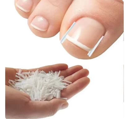 Toenail Correction Strips