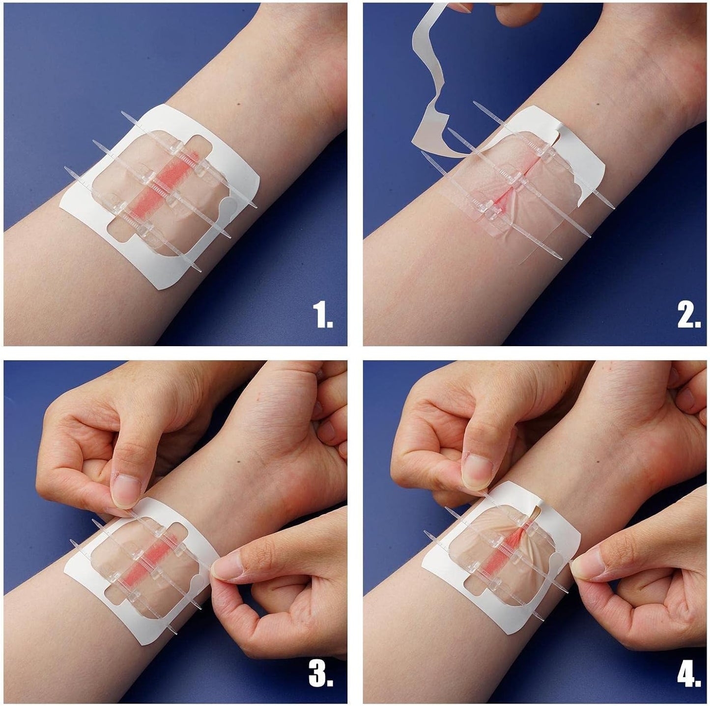 8Pcs Zipper Tie Wound Closure Patch