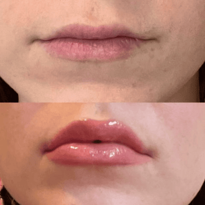 Volumising Lip Plumpler